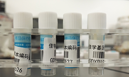 【佳學(xué)基因檢測(cè)】做Bosch-Boonstra-Schaaf視神經(jīng)萎縮綜合征基因解碼、<a href=http://alivewithwords.com/tk/jiema/cexujishu/2021/31933.html>基因檢測(cè)</a>需要多長(zhǎng)時(shí)間？