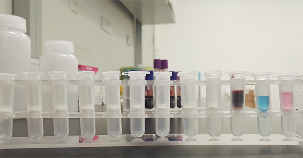 【佳學基因檢測】Brown-Vialetto-VanLaere綜合征2型基因解碼、<a href=http://alivewithwords.com/tk/jiema/cexujishu/2021/31933.html>基因檢測</a>報告看得懂嗎？