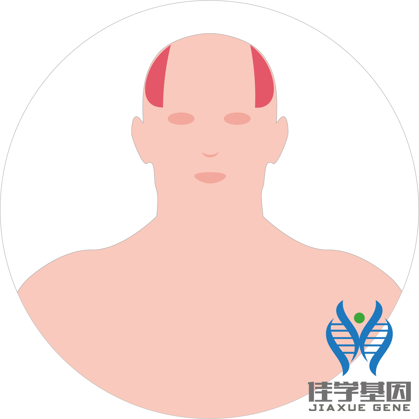 【佳學(xué)基因檢測】男性<font color='red'>脫發(fā)</font>（Androgenetic alopecia）基因解碼、<a href=http://alivewithwords.com/tk/jiema/cexujishu/2021/31933.html>基因檢測</a>
